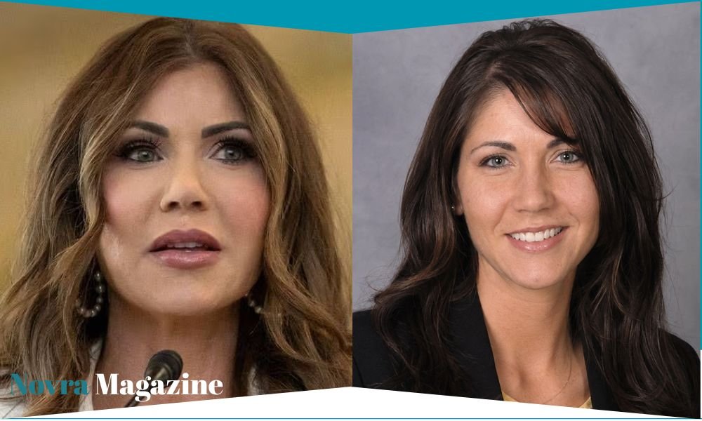 kristi noem before plastic surgery